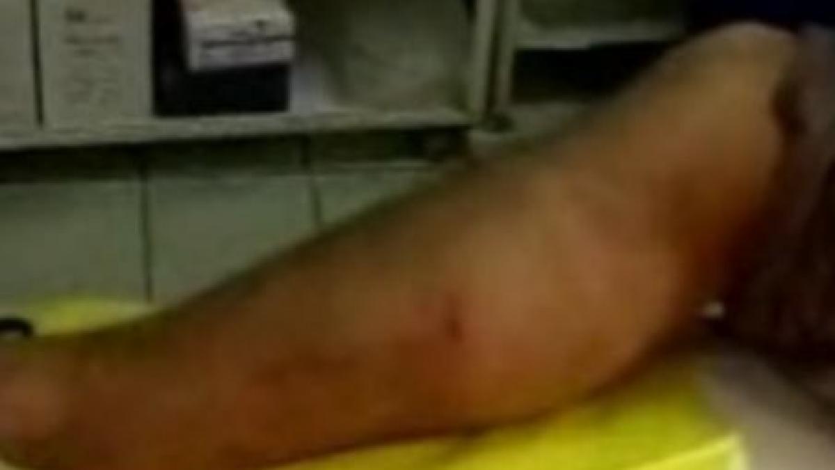 un iesean a ajuns la spital dupa ce a fost muscat de sarpe video