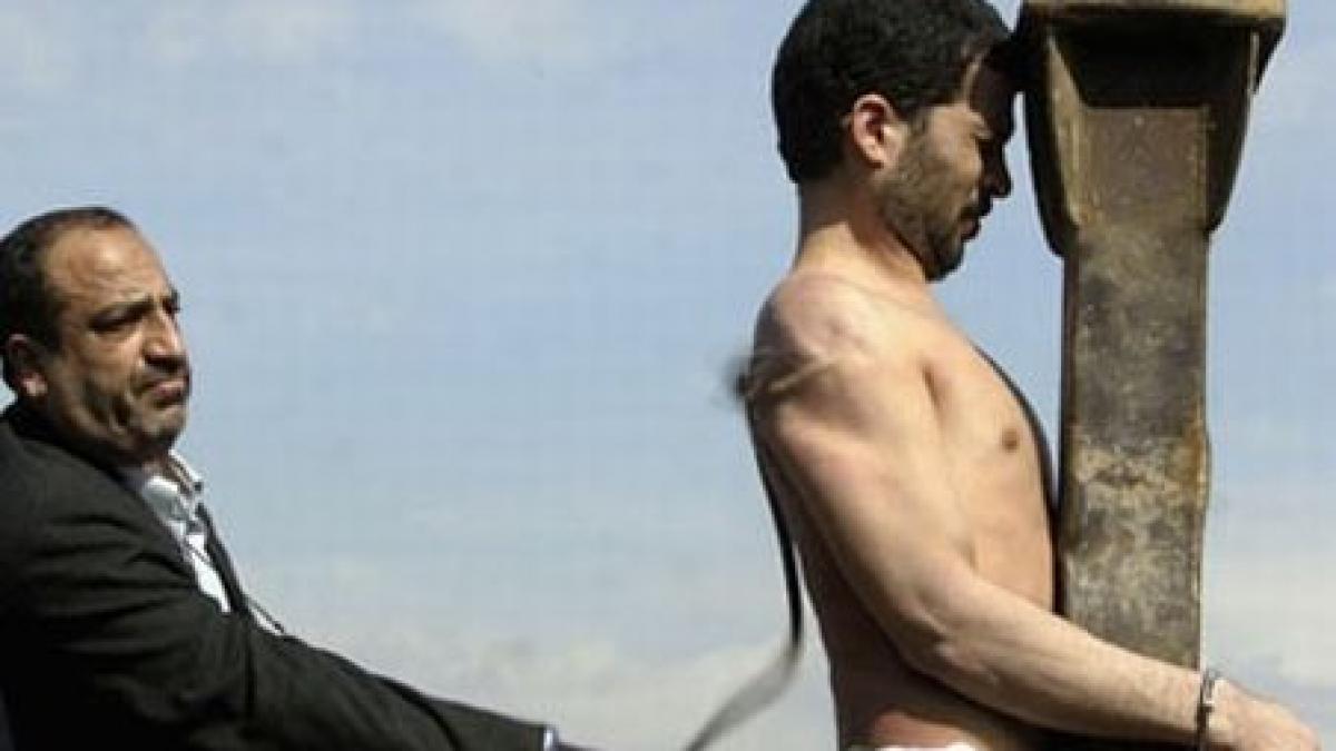 iran un barbat a fost condamnat la amputarea mainilor pentru ca a furat ciocolata