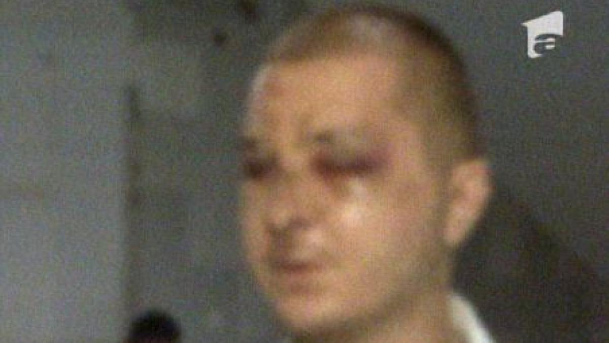 tanarul desfigurat in bataie inainte de meciul steaua dinamo asteapta sa i se faca dreptate