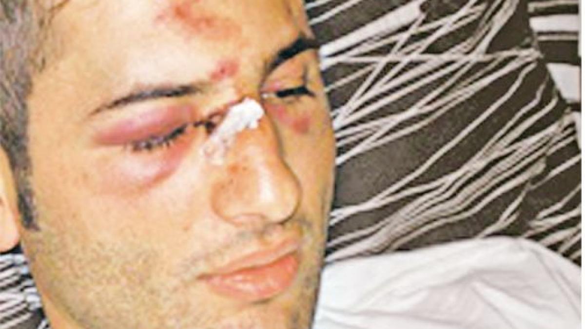 victima lui mutu prezinta primele imagini ale agresiunii salbatice vezi ce i ar face prandelli