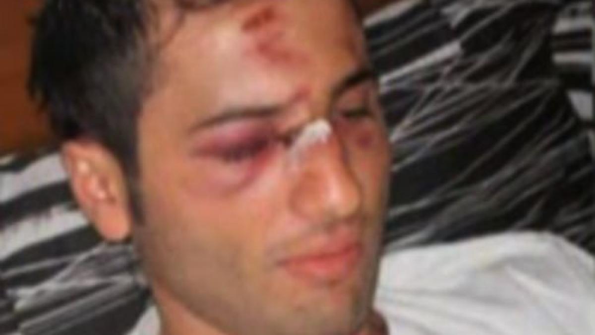 primele declaratii ale victimei lui mutu nu l am jignit i am cerut si scuze