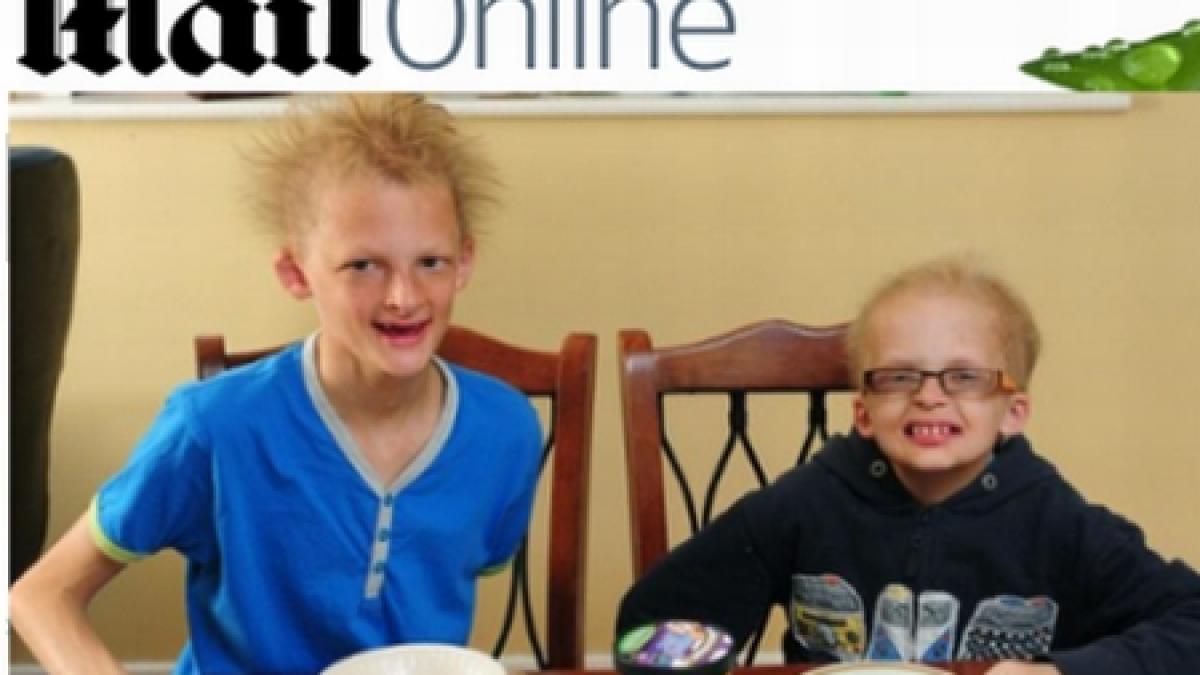 doi copii britanici sufera de un sindrom care ii face sa semene cu vampirii