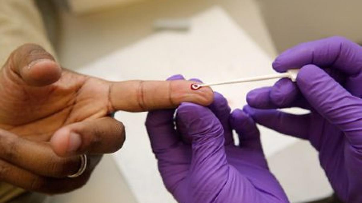 studiu o treime din persoanele seropozitive din europa nu stiu ca sunt infectate cu hiv