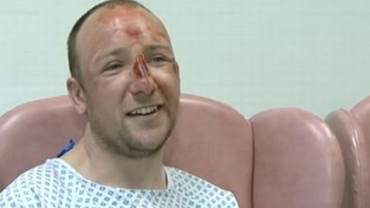 supravietuire miraculoasa a scapat cu viata dupa ce a cazut de pe o stanca de 300 de metri