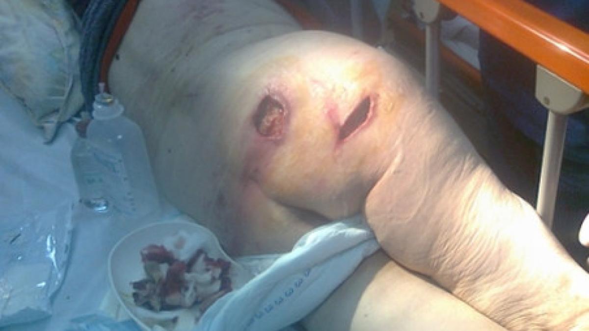 imagini socante cum arata o pacienta ingrijita intr un spital din constanta