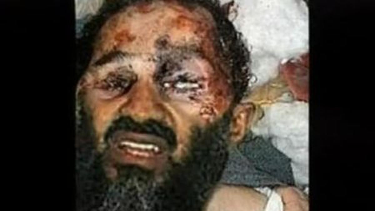 fotografia care il prezinta pe bin laden desfigurat un fals