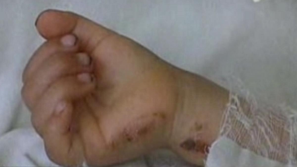 galati un copil de patru ani si a oparit fratele de trei ani