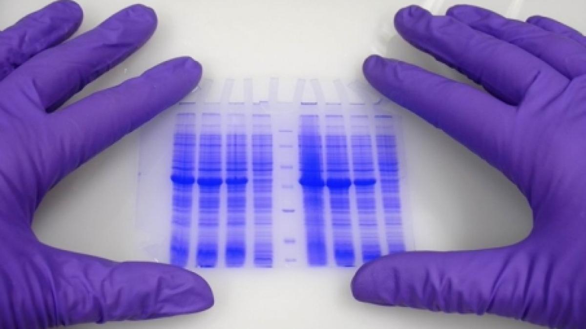 bacteria e coli care a facut 18 decese foarte rezistenta la antibiotice