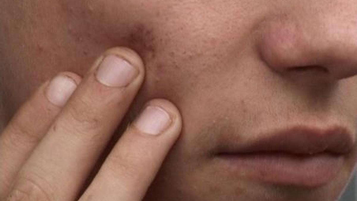 bistrita un elev a ramas fara dinti dupa ce a fost batut de un coleg