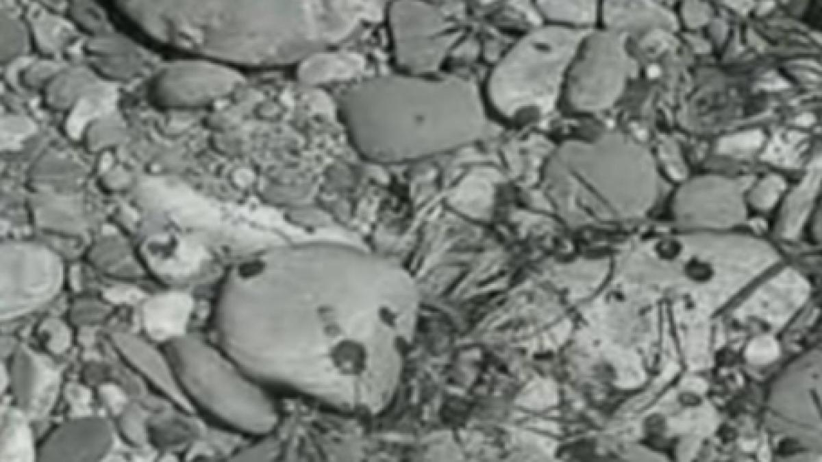 un baiat de 11 ani a ramas fara un picior dupa ce a cazut un bloc de beton peste el