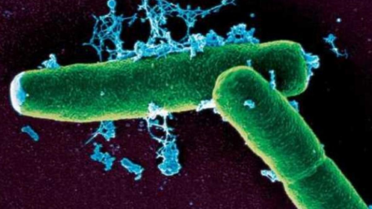focare de antrax depistate la granita serbiei cu romania au fost instituite zone de carantina