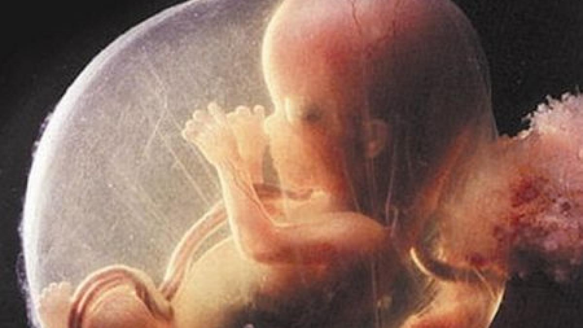 medici din iasi suspectati ca au facut avorturi ilegale 1 000 de euro pentru o intrerupere de