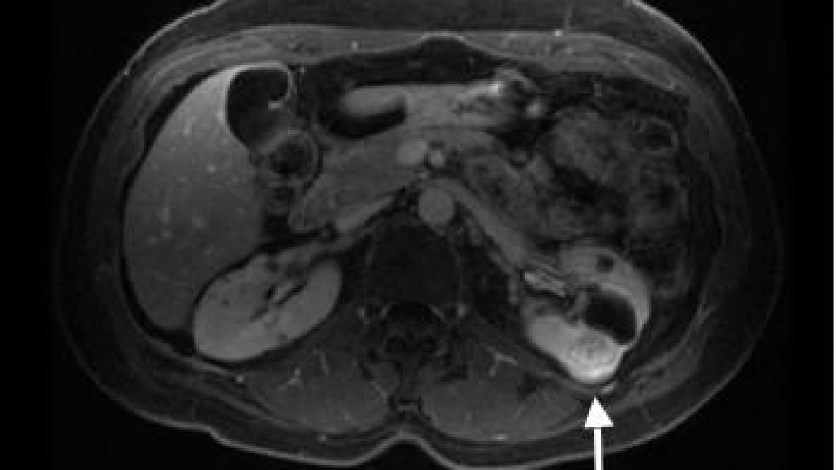 sanatatea romanilor este din ce in ce mai subreda vezi aici detalii si recomandari