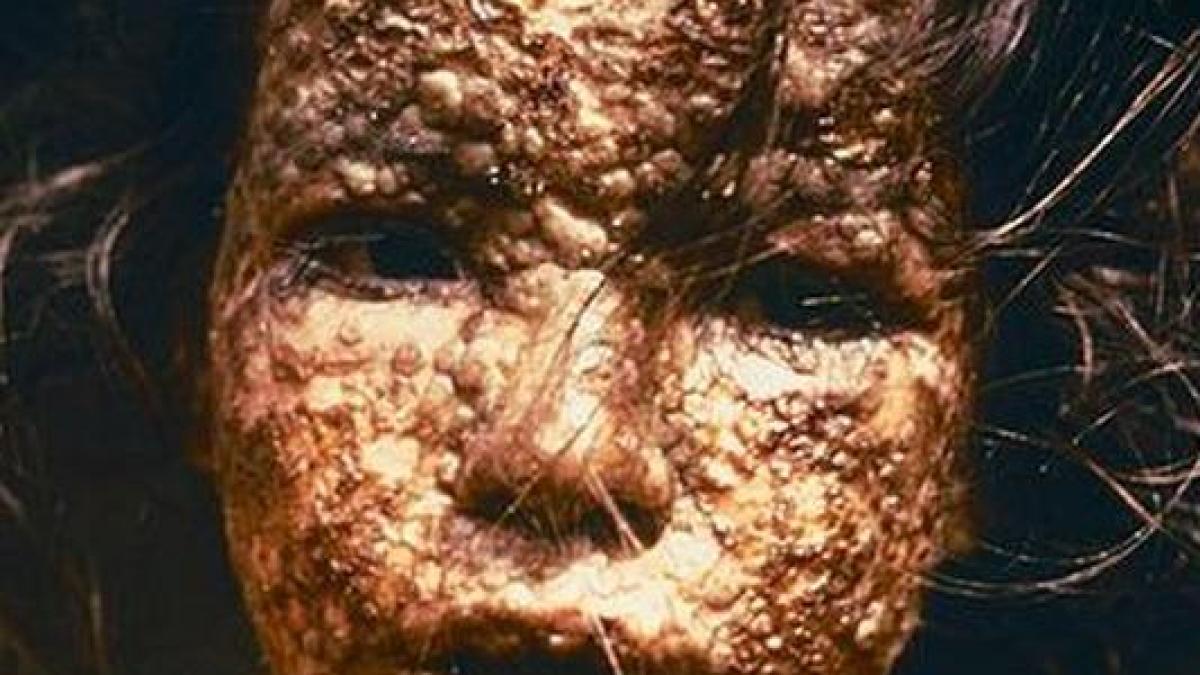 contagiunea cand virusii scapa de sub control vezi un top cu cele mai grave maladii din lume