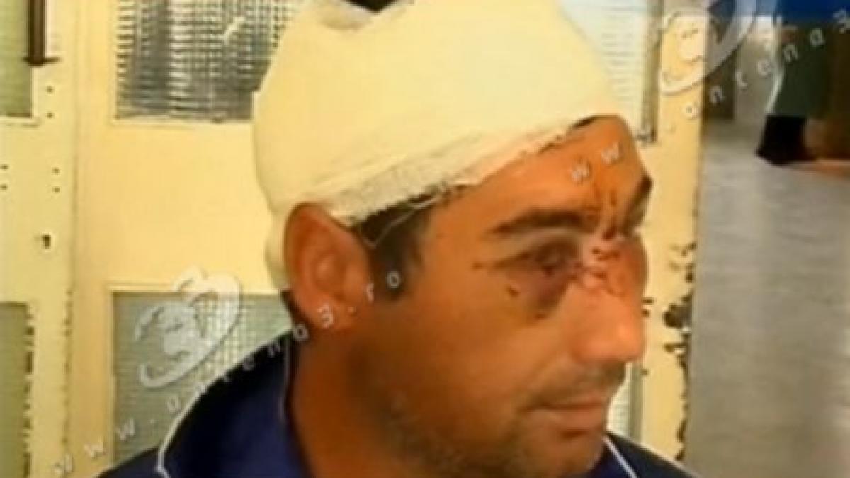 galati un barbat a ajuns la spital batut si jecmanit de o ruda