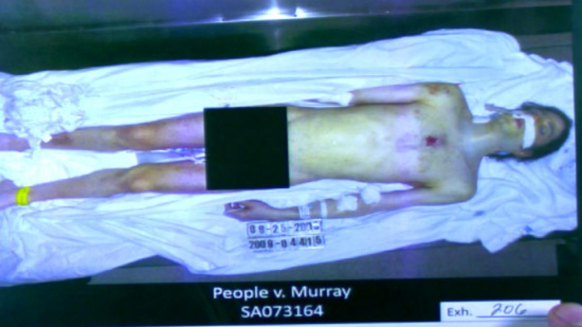 foto socante trupul lui michael jackson dezbracat pe masa de autopsie