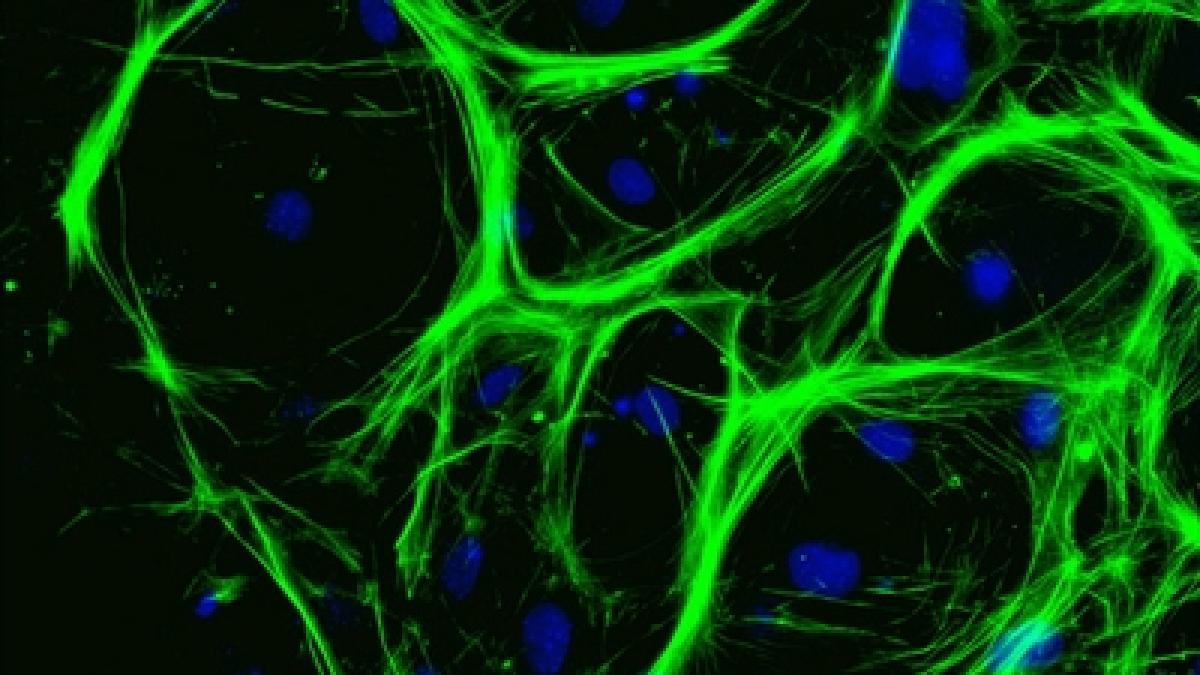 transplantul de ficat ar putea deveni amintire cercetatorii au dezvoltat celule hepatice din celule