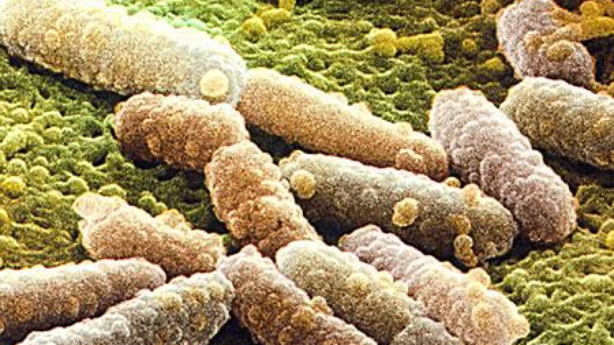 e cel mai periculos loc din casa ta 8 000 de bacterii pe cm2 unde nici nu te astepti