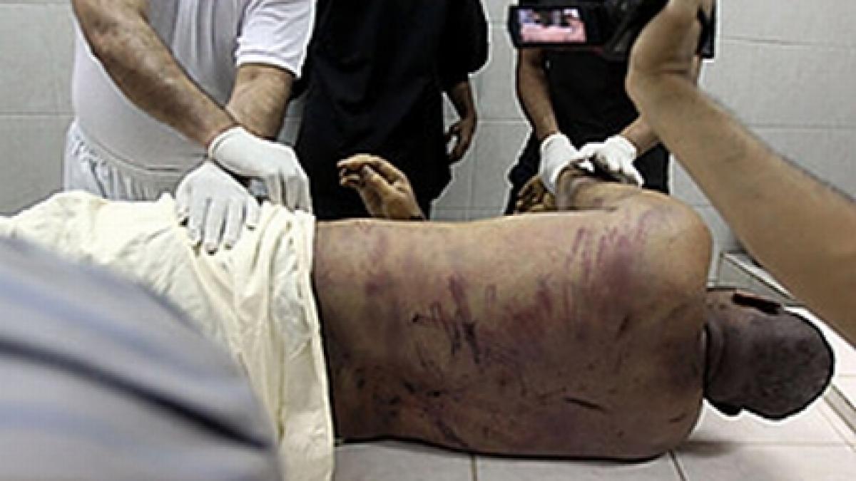 amnesty international siria foloseste spitalele pentru tortura