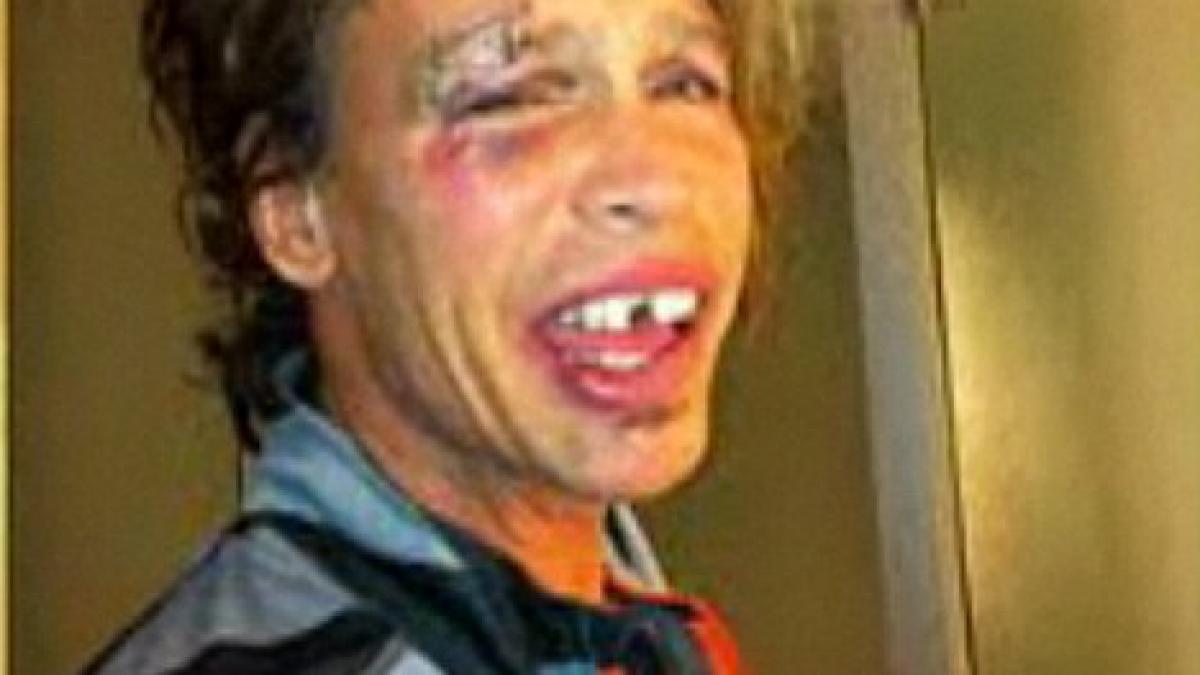 nu e costumatie de halloween trebuie sa fi durut ghici cine a ajuns sa arate in acest hal