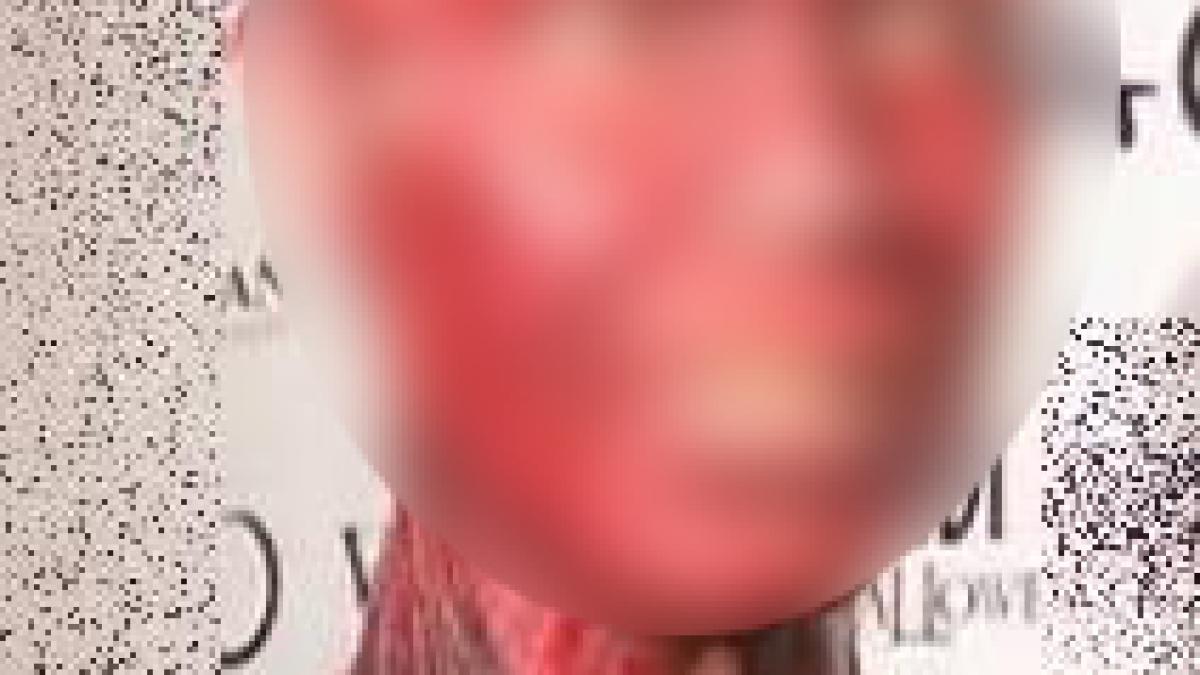 socant ce s a intamplat cu aceasta vedeta de a ajuns sa arate ca un monstru