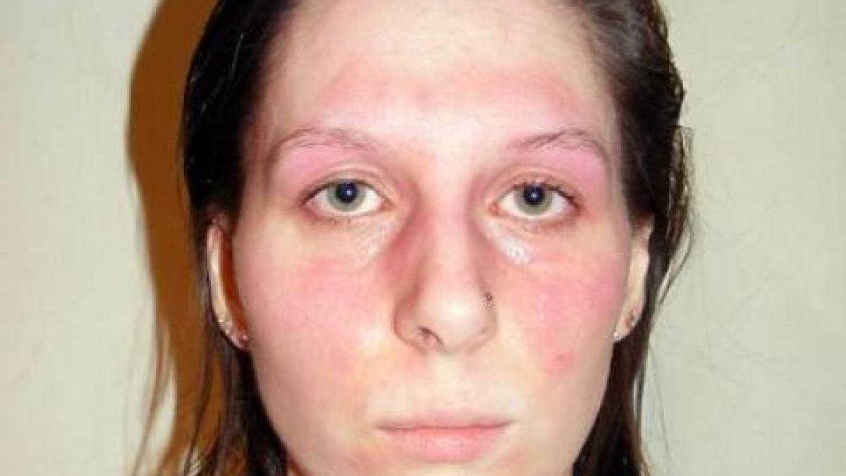 femeia alergica la viata povestea tragica a omului care este prizonierul propriei persoane