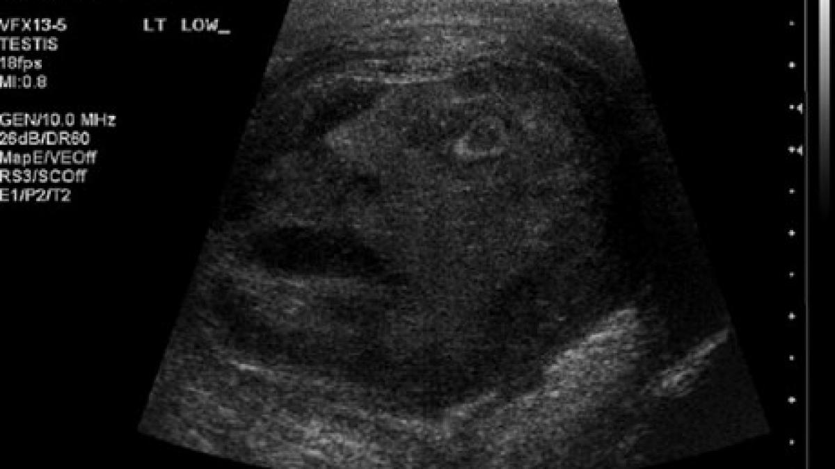 fata care i a socat pe medici nici prin gand nu iti trece unde au gasit o