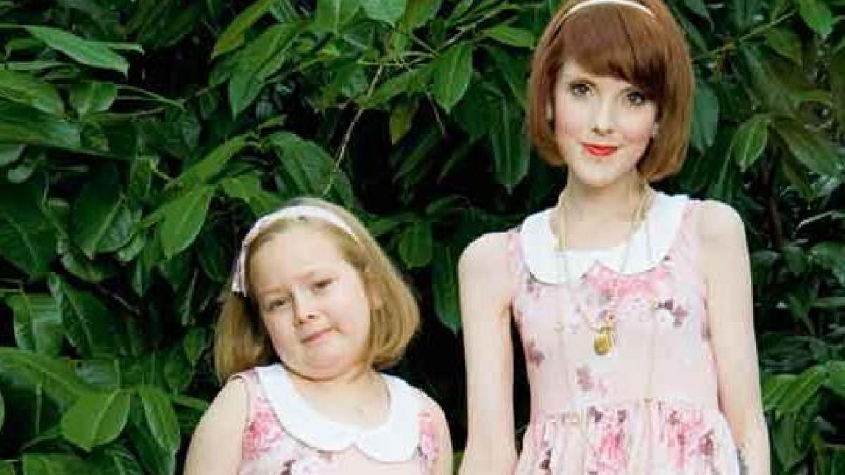 nu iti vei da seama cine sunt pana nu le vei citi povestea anorexia boala care distruge vieti