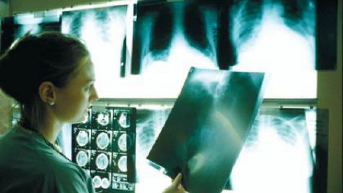 iasi doi copii de gradinita diagnosticati cu tuberculoza alti doi sunt suspectati ca ar avea tbc