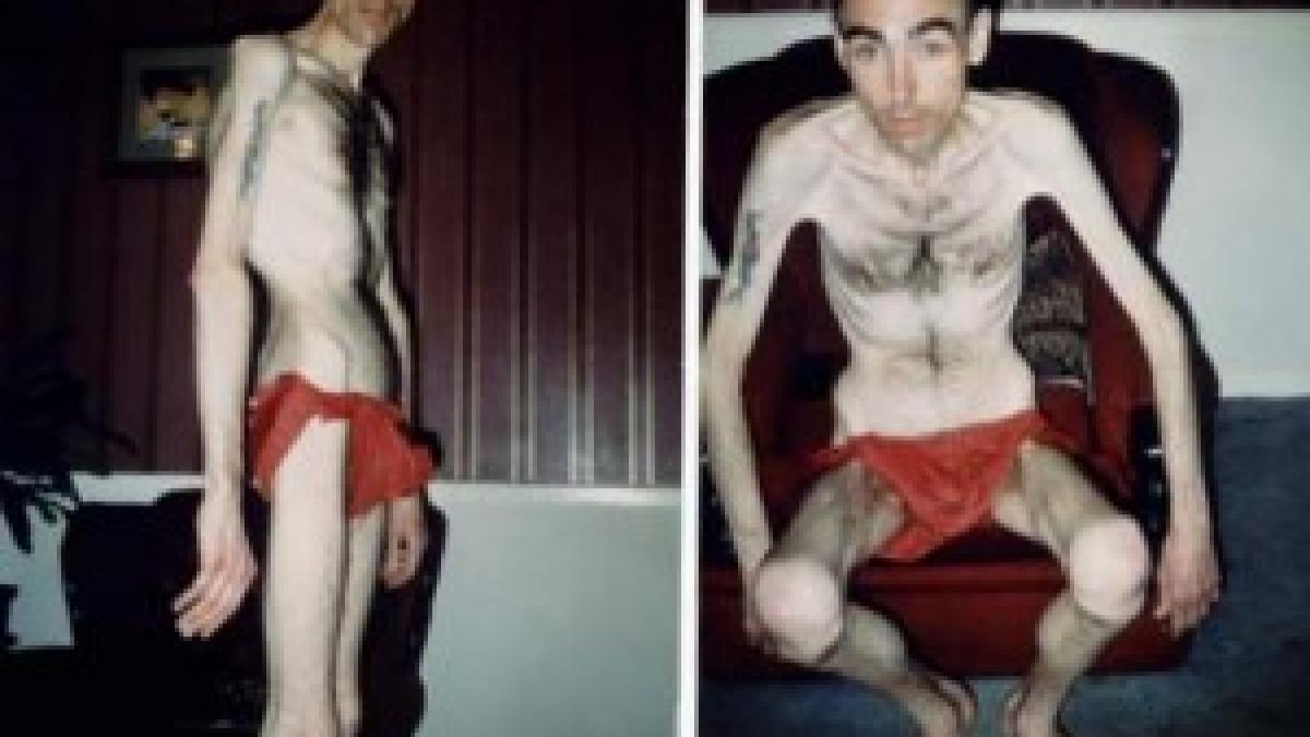 cum a ajuns sa arate asa boala de care poti suferi si tu fara sa stii