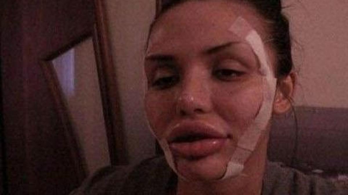 transformarea socanta din procesul plastifierea pitipoancei n o sa iti vina sa crezi ca e aceeasi