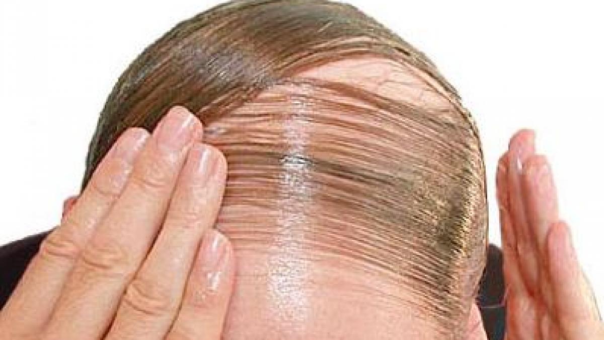 socant vezi ce super model a ajuns sa arate asa blestemul celebritatii i a distrus frumusetea