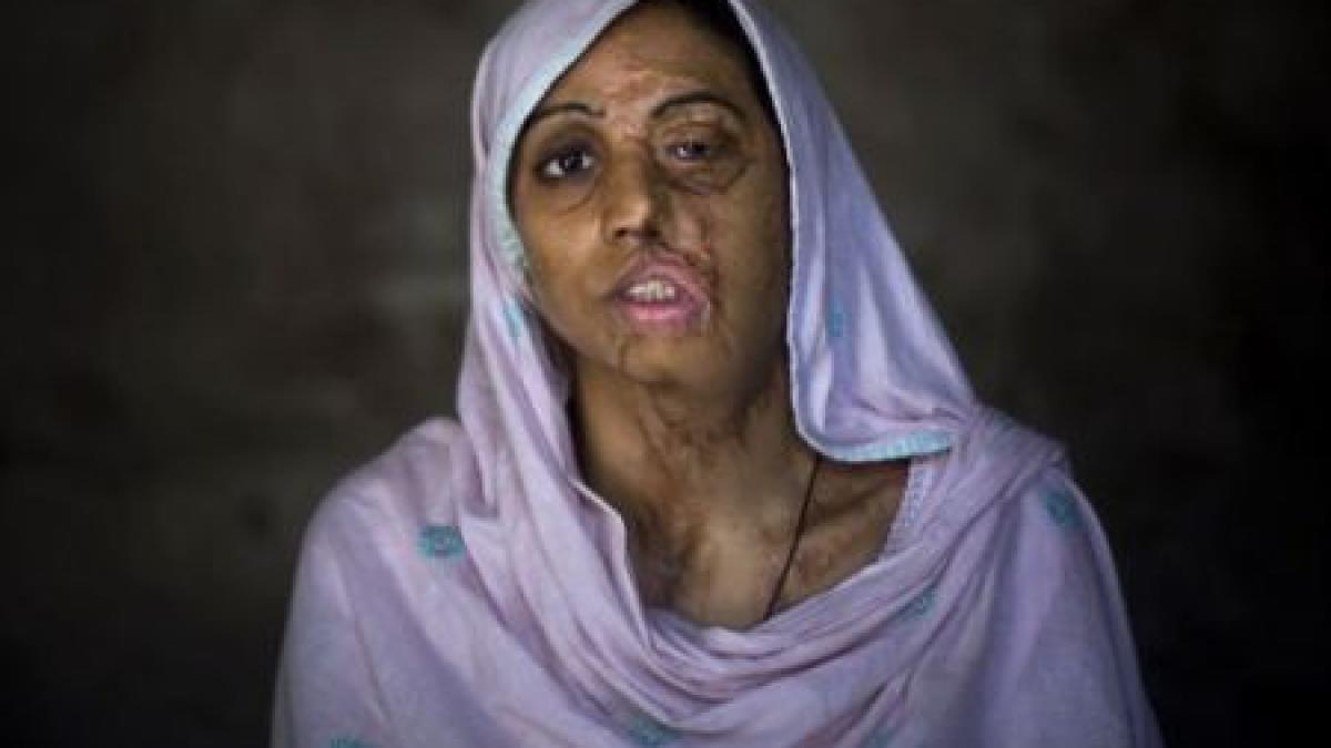 o familie din afganistan mutilata cu acid fiica cea mare a refuzat sa se casatoreasca cu un barbat