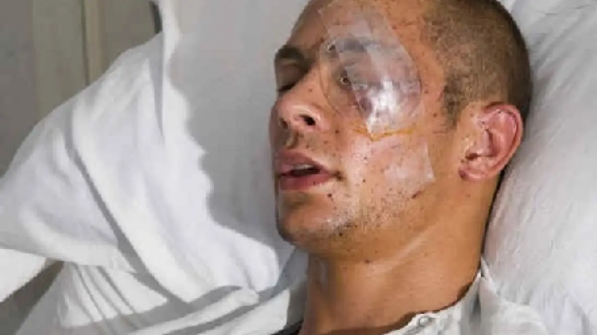 un sofer profesionist a ramas fara un ochi dupa ce i a explodat o petarda in fata