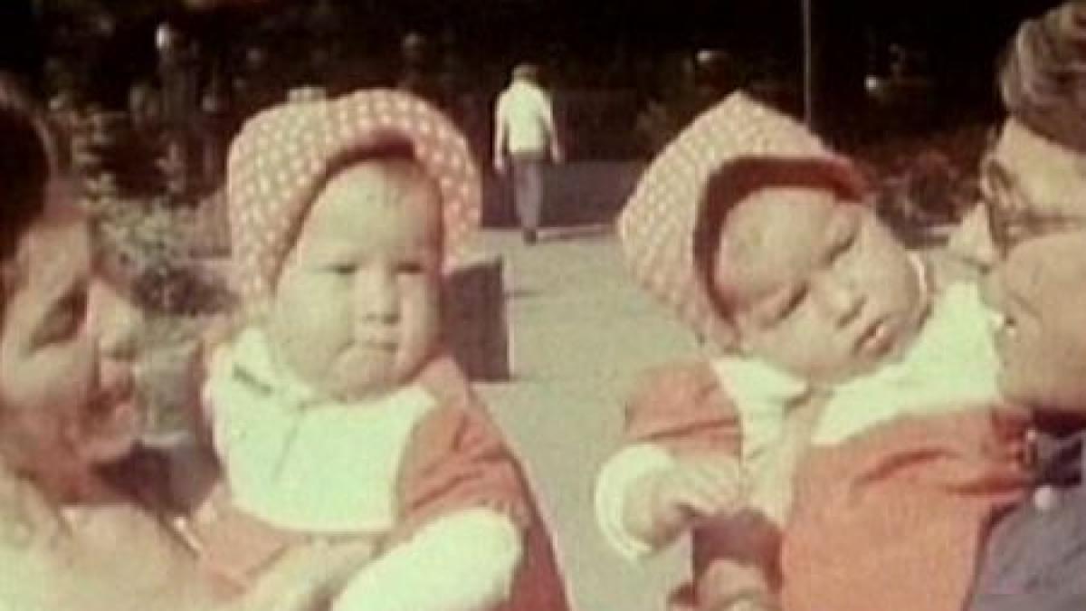 operatia de separare a siamezelor lina si gherghina a costat 3 milioane de dolari in anii 80