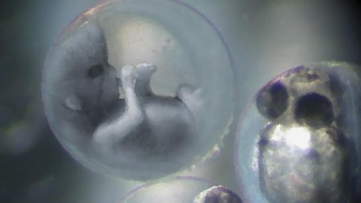 descoperirea care va revolutiona lumea bolile genetice eradicate copiii vor avea trei parinti