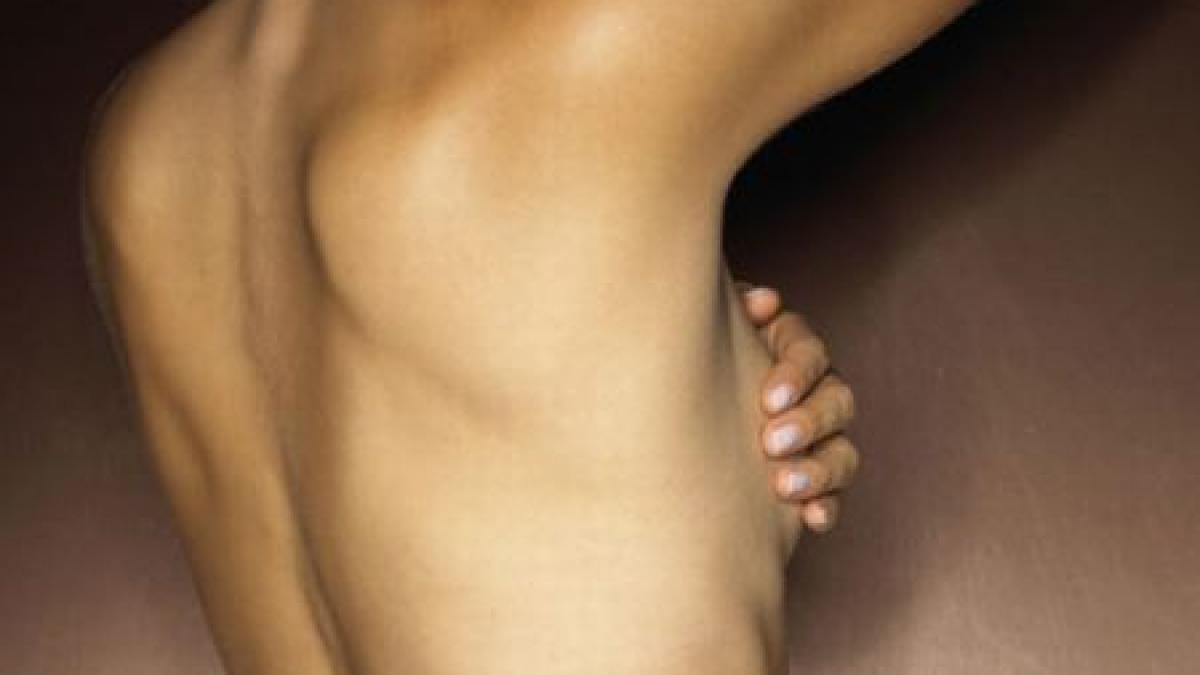 mutilata de boala si nedreptatita de autoritati a invins cancerul dar inca se lupta cu statul