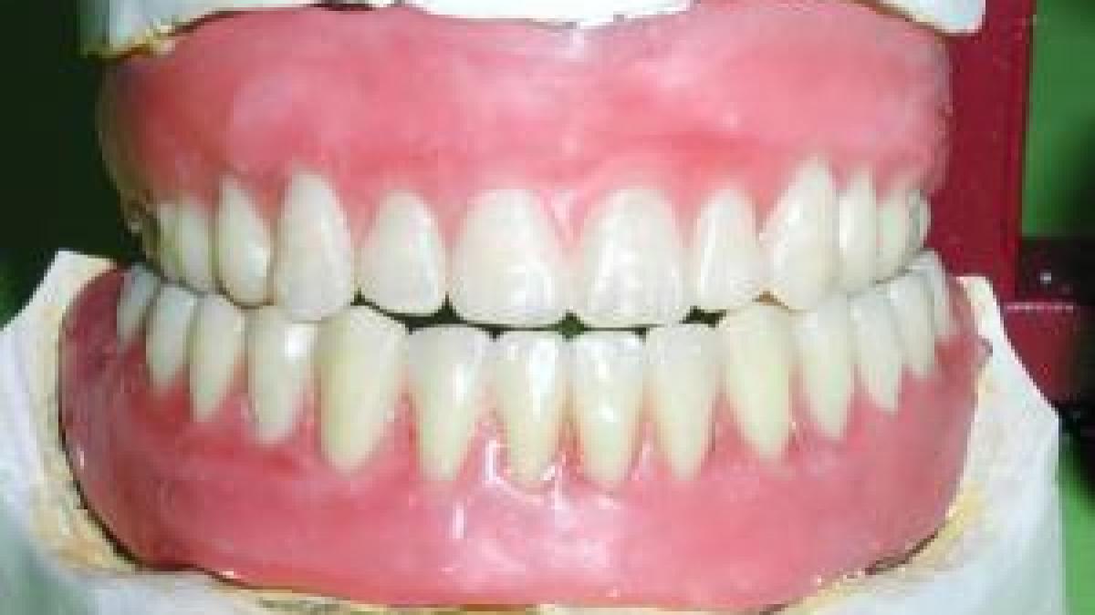 a jefuit o banca pentru o proteza dentara