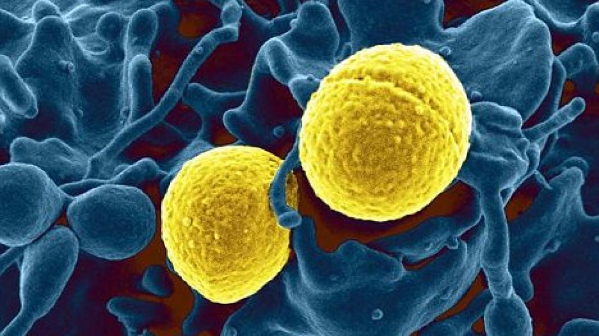 bacteria mortala care baga in sperieti europa o poti lua din autobuz sau tren si iti roade carnea