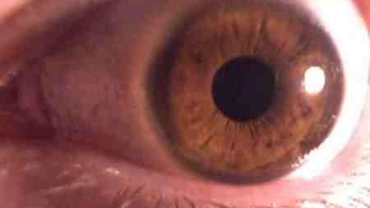 boala secolului xxi pe care risti sa o ai fara sa stii 1 din 4 oameni sufera de ea adevarul te face