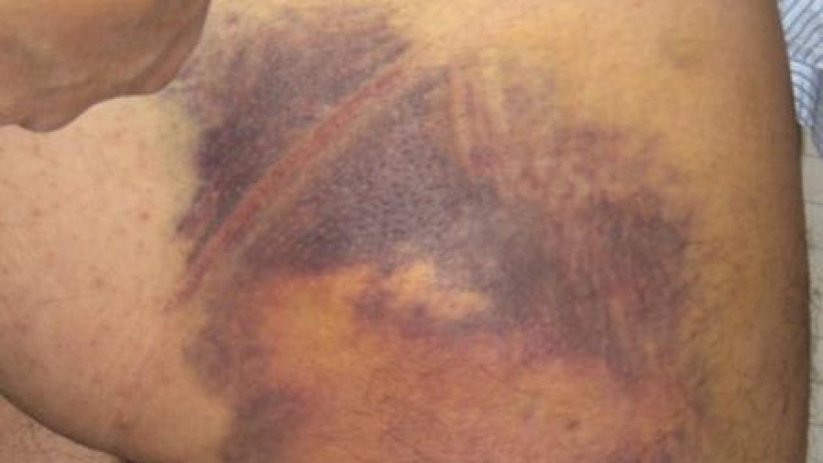 batuta de soarta si de oamenii care ar fi trebuit sa aiba grija de ea drama unei fete din baia mare