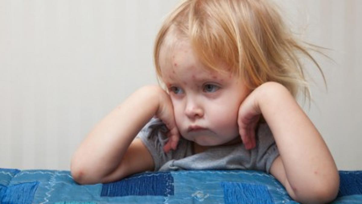 trei focare de varicela confirmate in mai multe gradinite din vaslui si barlad 40 de copii bolnavi