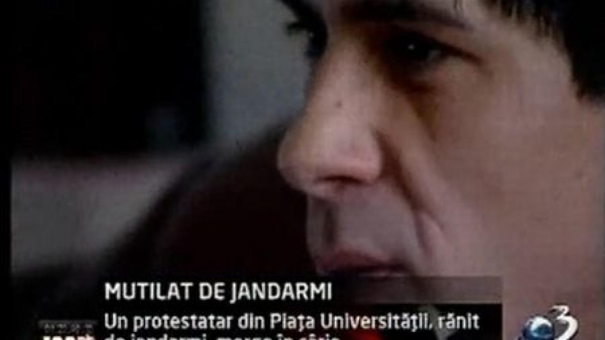 povestea tragica a unui protestatar mutilat de jandarmii din piata universitatii vezi imagini