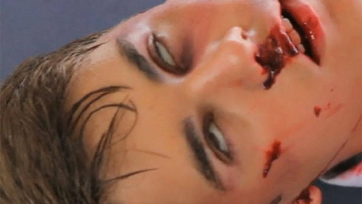 s au temut ca il vor pierde pentru totdeauna idolul a milioane de adolescenti plin de sange