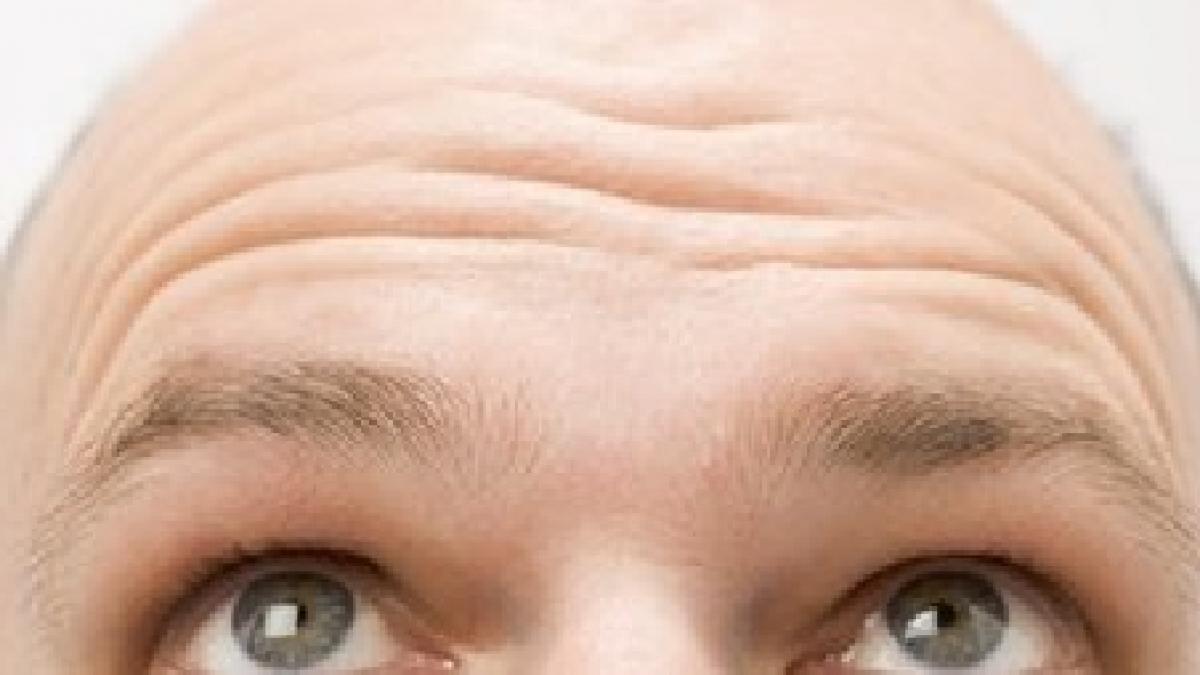 poti scapa definitiv de caderea parului savantii americani sunt pe cale sa obtina un tratament