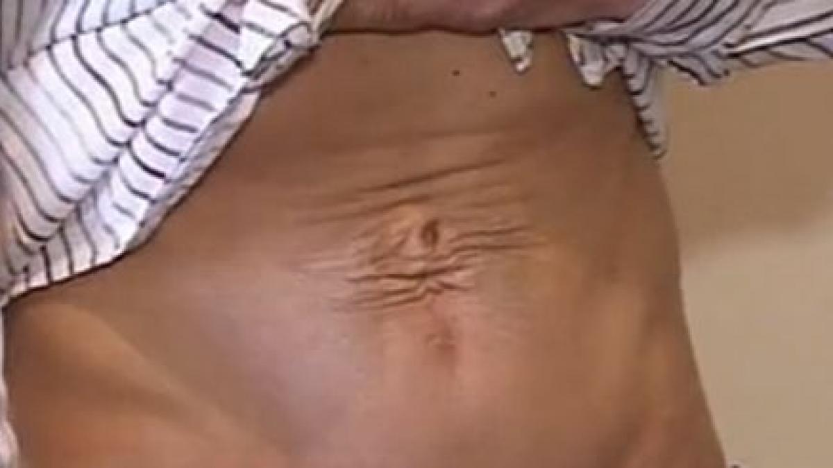 craiova o tanara il acuza pe medicul care i a facut o operatie estetica ca a mutilat o