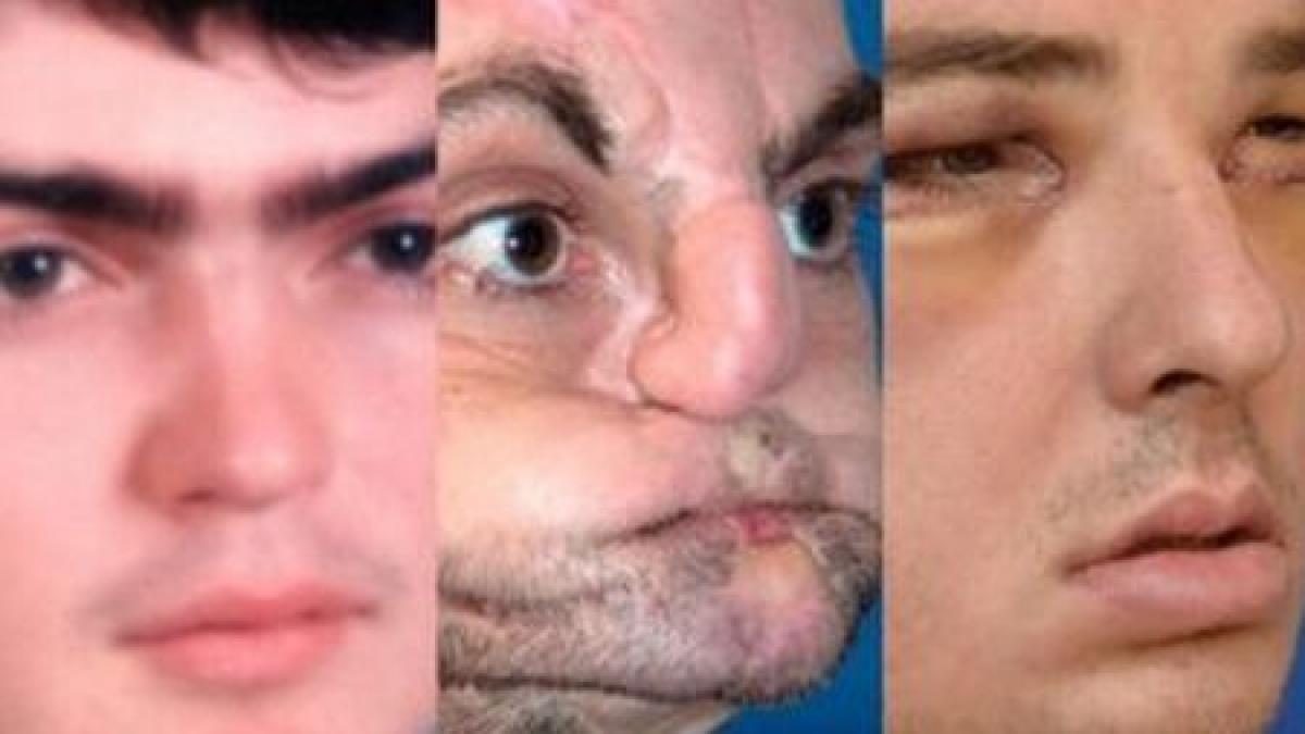 cand dumnezeu lucreaza cu mainile doctorilor cum arata un american care a suferit un transplant de