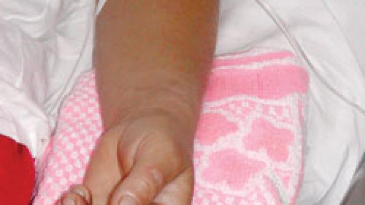 cornulet cu lapte expirate 12 copii au ajuns la spital cu toxiinfectie alimentara