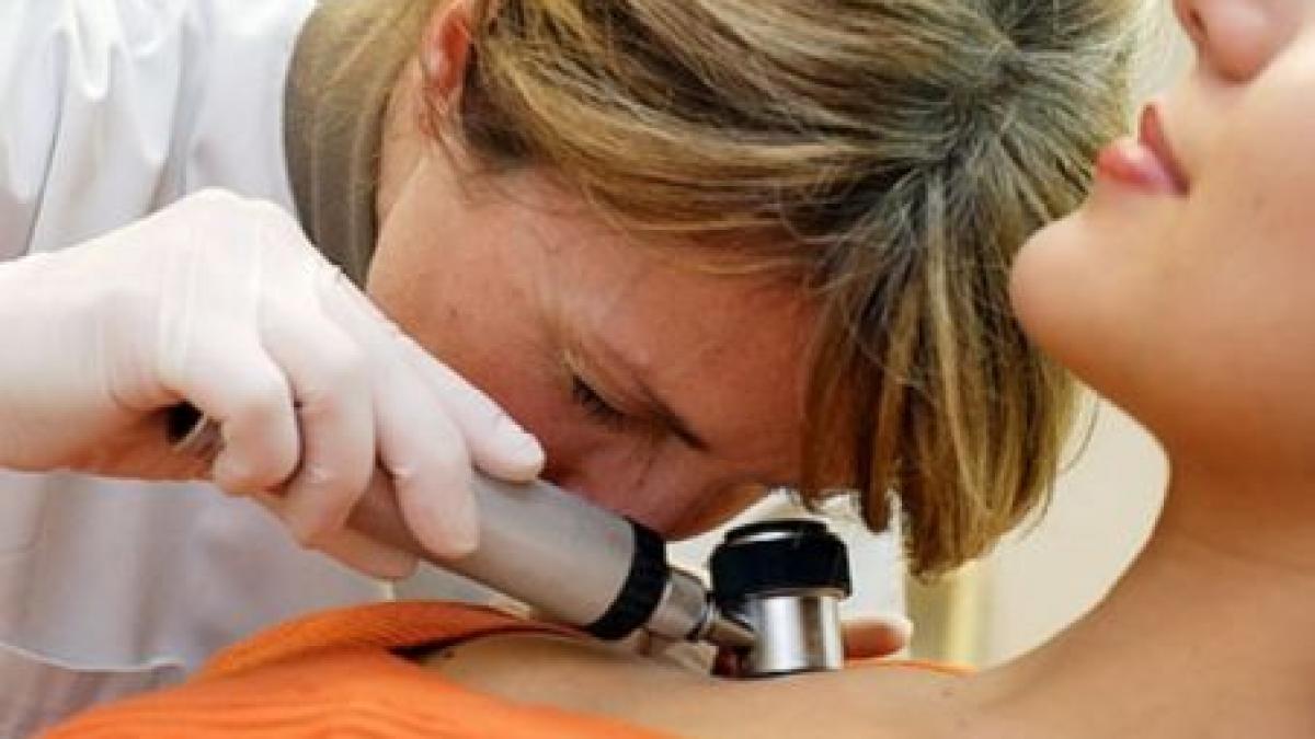 crestere alarmanta a numarului de cazuri de cancer de piele la persoane sub 40 de ani