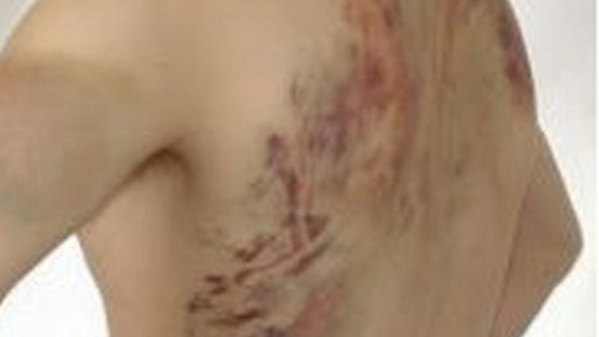 o familie din botosani batuta crunt de un vecin copilul a ajuns cu fracturi la spital